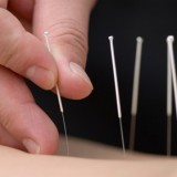 Kwetsbare ouderen lopen beter na acupunctuur